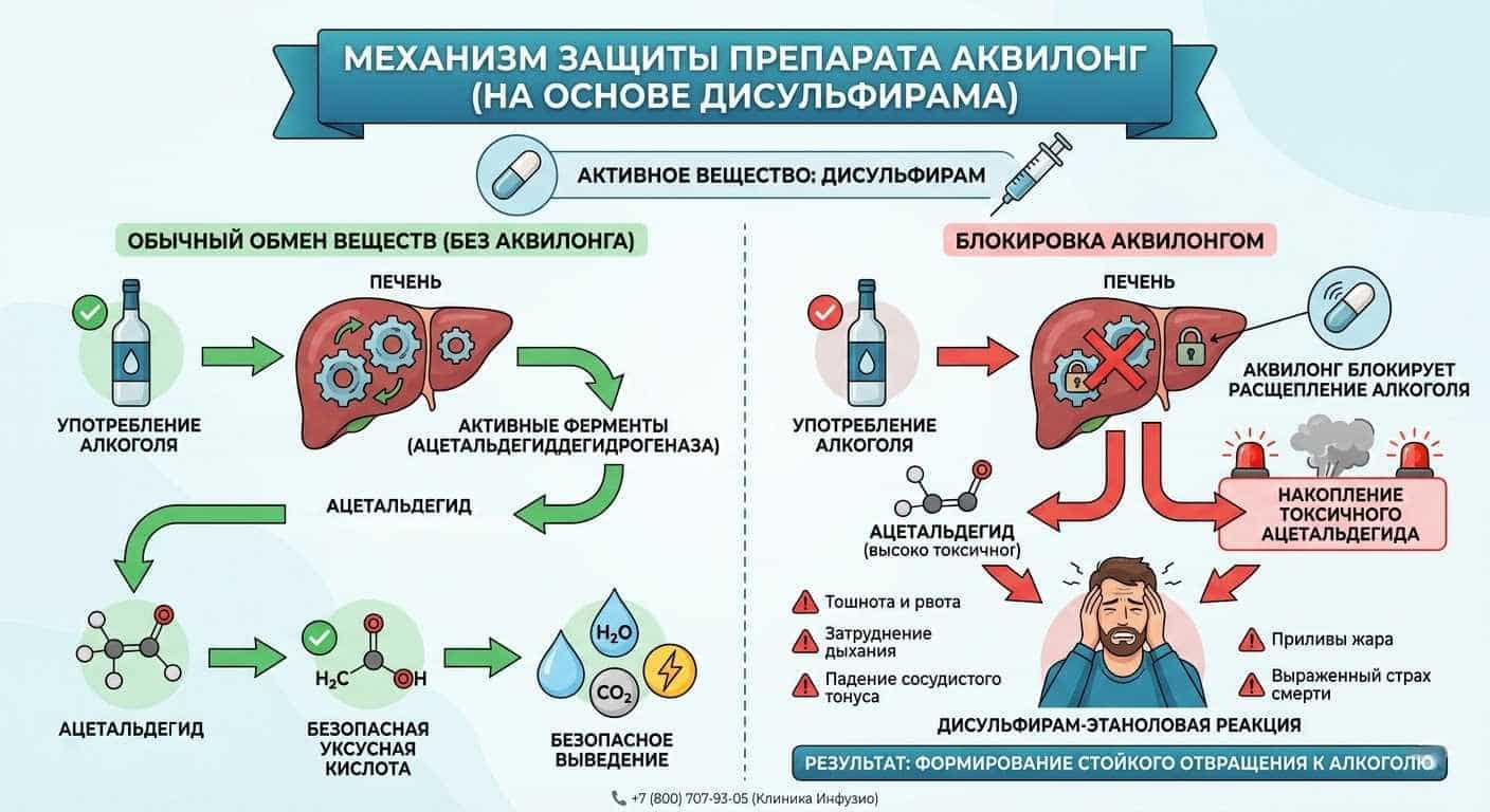 Схема механизма действия препарата Аквилонг на основе дисульфирама при кодировании от алкоголизма